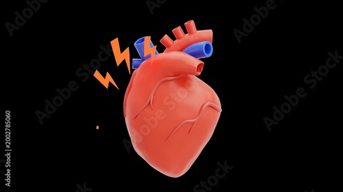3D Heart Attack | Alpha Channel