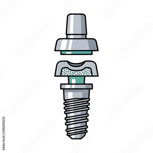A detailed illustration of a dental implant component for medical procedures