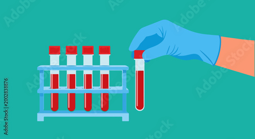 Medical blood test tubes in laboratory rack, gloved hand holding vacuum vial with blood sample, clinical diagnostic hematology vector illustration