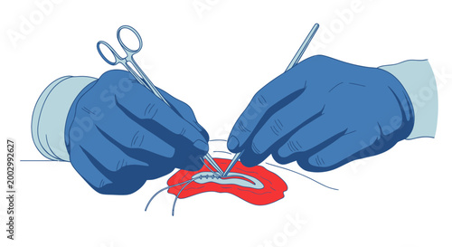 Surgeon's Hands Performing Surgical Stitching with Scalpel and Forceps
