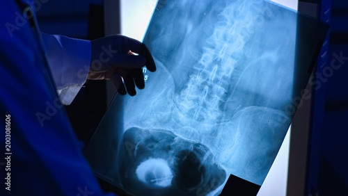 Doctor. X-ray. Spine. . High quality photo