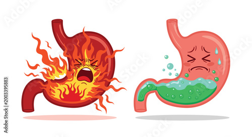 Two personified stomach characters representing the pain and discomfort of heartburn and a generic upset stomach.