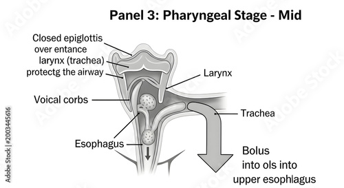 Pharyngeal stage of swallowing mechanism showing bolus movement through throat.
