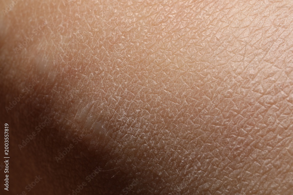 Fototapeta premium Texture of dry skin as background, closeup