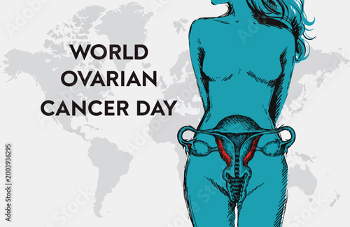 World Ovarian Cancer Day Awareness Poster Showing Female Reproductive Anatomy and Global Support