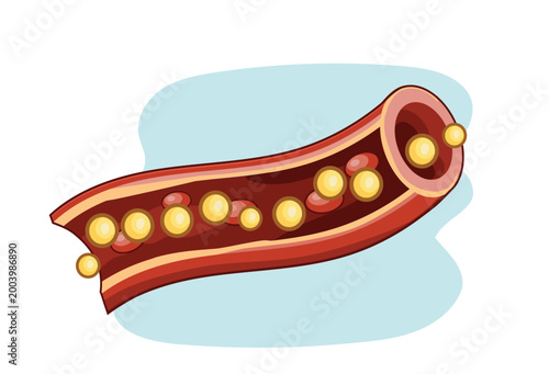 Fatty Acids Transport in Bloodstream Artery Medical Illustration