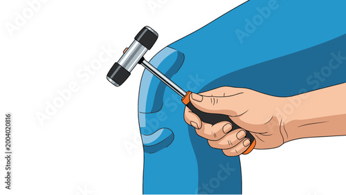 Doctor's hand holding a reflex hammer performing a neurological examination on a patient's knee to test reflexes in a medical clinic setting.