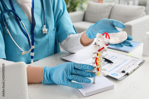 Female doctor with spine model at table in clinic, closeup