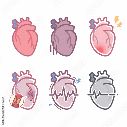 Medical illustration of human heart conditions including healthy, heart attack, arrhythmia and failure
