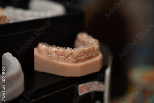 3D printed dental model and dental plaque.