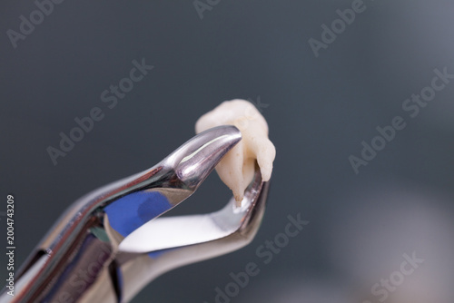 Close up of the tooth root