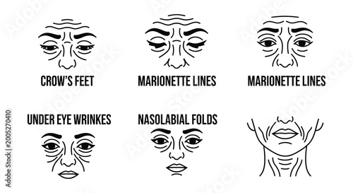 Schilderij op canvas Facial wrinkle diagrams line art illustrations on white background