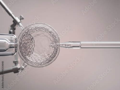 Microscopic view of an embryo being handled with a laboratory pipette for IVF treatment.