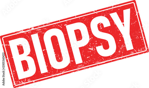 Tableau sur toile BIOPSY in distressed white letters on a red rectangular rubber stamp imprint