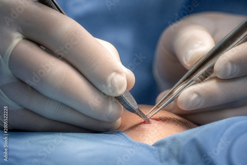 surgeon holding a syringe
