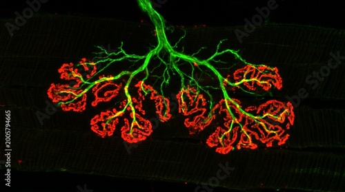 Neuromuscular Junction Acetylcholine Receptor Mapping