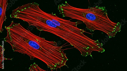 Smooth Muscle Cell Actin Cytoskeleton Immunofluorescence