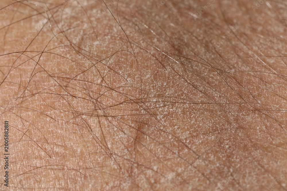 Fototapeta premium Texture of dry skin as background, closeup