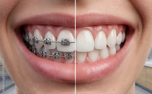 teeth