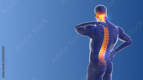 Foto Medical concept of the neck and back pain