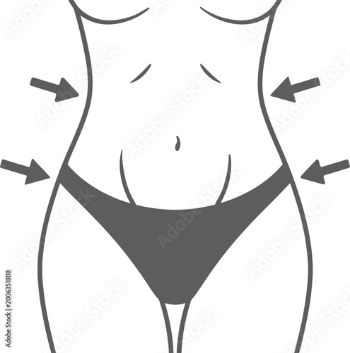 A flat minimalist vector illustration shows a slim female waistline with arrows indicating weight loss and body contouring treatment results