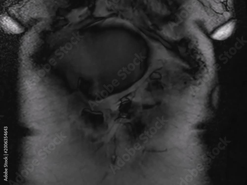Abdominal Magnetic Resonance Imaging scan showing internal organs. Detailed clinical view of human anatomy captured through advanced medical diagnostic radiology for healthcare education and research