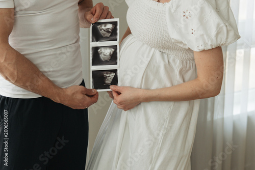 Pregnant couple holding ultrasound scan, expecting baby, family planning, pregnancy and parenthood concept