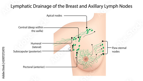 Φωτογραφία Lymphatic Drainage of the Breast
breast lymphatic drainage pathways showing axillary, apical, and parasternal lymph nodes, commonly used in breast cancer diagnosis and education