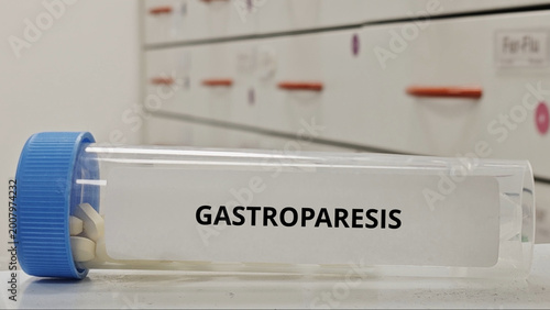 Bild auf Leinwand GASTROPARESIS treatment tablets for improve gastric motility and digestion