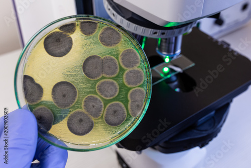 Canvas Print A petri dish with round gray colonies of dangerous mold against the backdrop of a working microscope