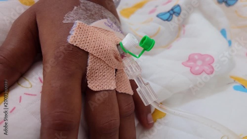 Medical procedure taking place on a hand in a hospital setting during daytime hours with IV setup for patient care