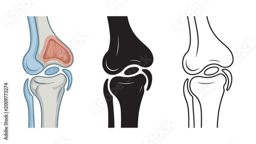 Bild auf Leinwand Human knee replacement surgery icons illustrating joint anatomy, prosthetic implant design, orthopedic reconstruction, and medical rehabilitation concept