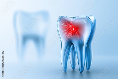 Toothache conceptual illustration isolated on white background