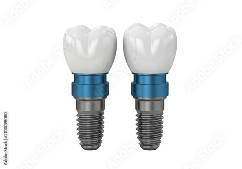 Dental implants with blue abutment connectors displayed side by side isolated on transparent background
