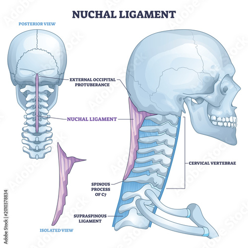 Obraz na plátně Nuchal ligament outline illustrates its path from external occipital protuberance to cervical vertebrae, key objects, skull, cervical spine, ligament