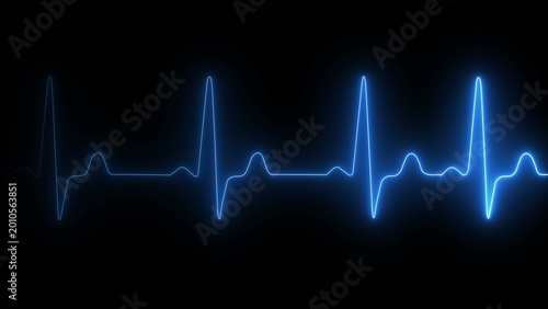 Fotografía Bright blue heartbeat line showing a healthy pulse wave on a dark black backgrou