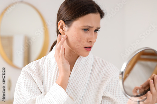 Young woman with acne probl...