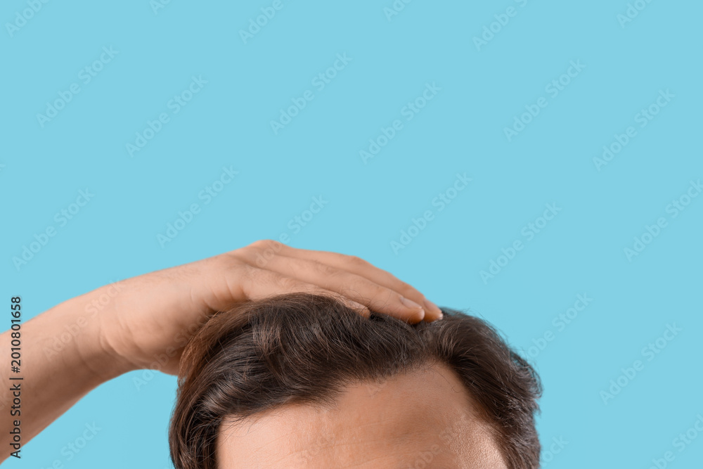Fototapeta premium Man touching head on blue background, closeup. Hair loss problem