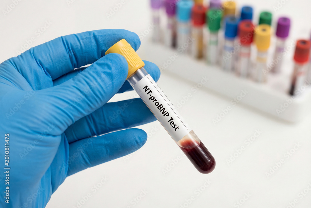 Naklejka premium Hand in blue glove holding NT probnp blood test tube