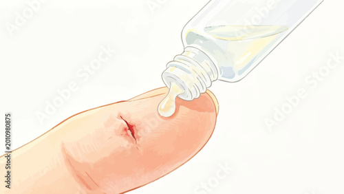 Soft Watercolor Close-Up Illustration of Antiseptic Liquid Being Applied to a Small Open Cut on a Human Finger, Demonstrating Home First Aid Wound Disinfection