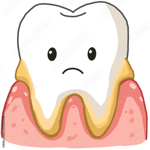 Tooth Plaque