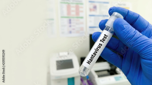 Scientist hand holding Hantavirus test tube in laboratory. Medical research, infectious disease testing, diagnostic safety and lab procedures concept.