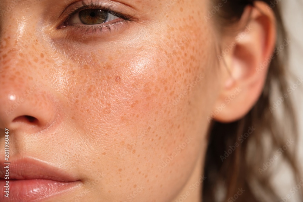 Naklejka premium Close-up of a woman's freckled face highlighting natural skin texture, freckles, and smooth complexion with a soft light source.