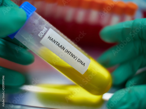 An epidemiologist holds a vial containing a sample for hantavirus virus analysis in a laboratory