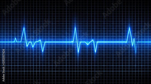 Electrocardiogram reading on a screen.