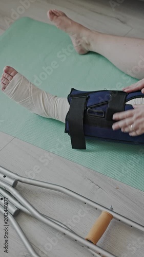 Woman in bandage with broken leg and ankle with crutches at home