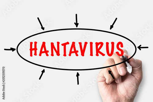 Tableau sur toile Hantaviruses are a genus of rodent-borne, enveloped RNA viruses (family Hantavir