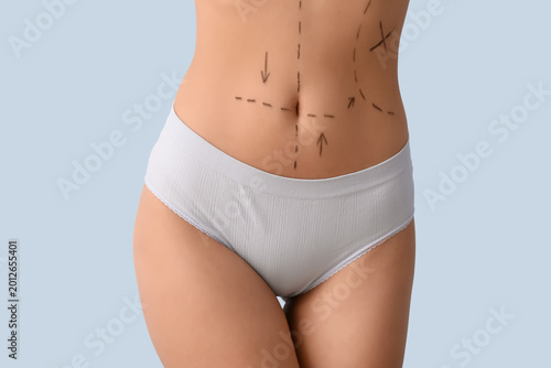 Bild auf Leinwand Young woman in underwear with marks on her abdomen against light background, closeup