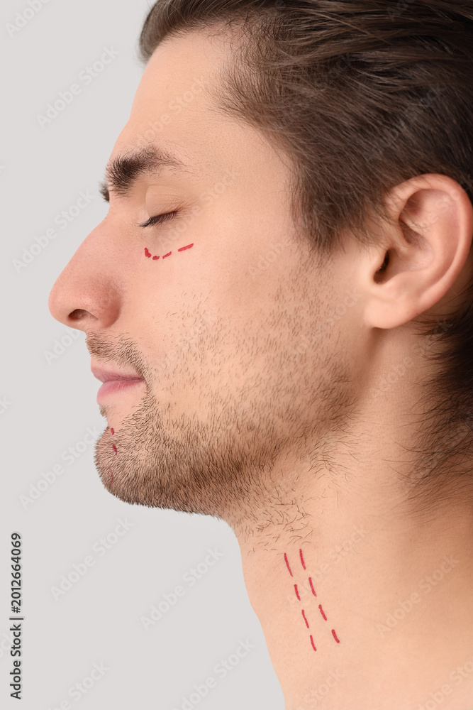 Fototapeta premium Young man with marked face on light background, closeup. Plastic surgery concept