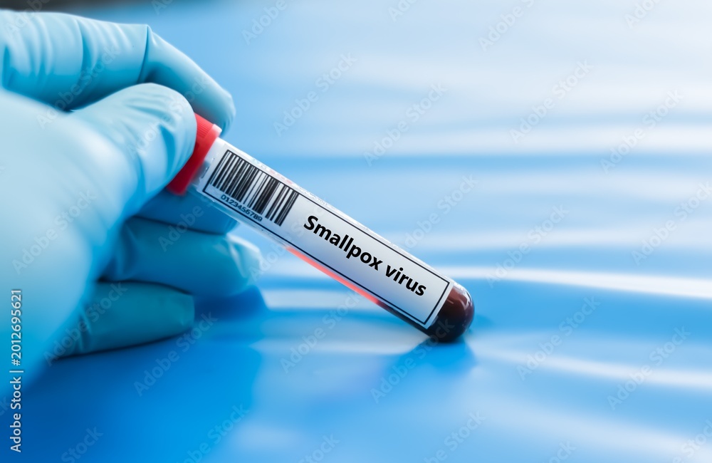 Fototapeta premium Blood sample tube for smallpox virus test analysis.